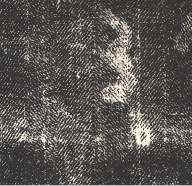 Sur cet agrandissement, on retrouve le caillot form� par le sang issu de la veine frontale et dont la forme particuli�re vient de ce qu'il a �pous� les rides qui barraient le front.   (12188 octets)